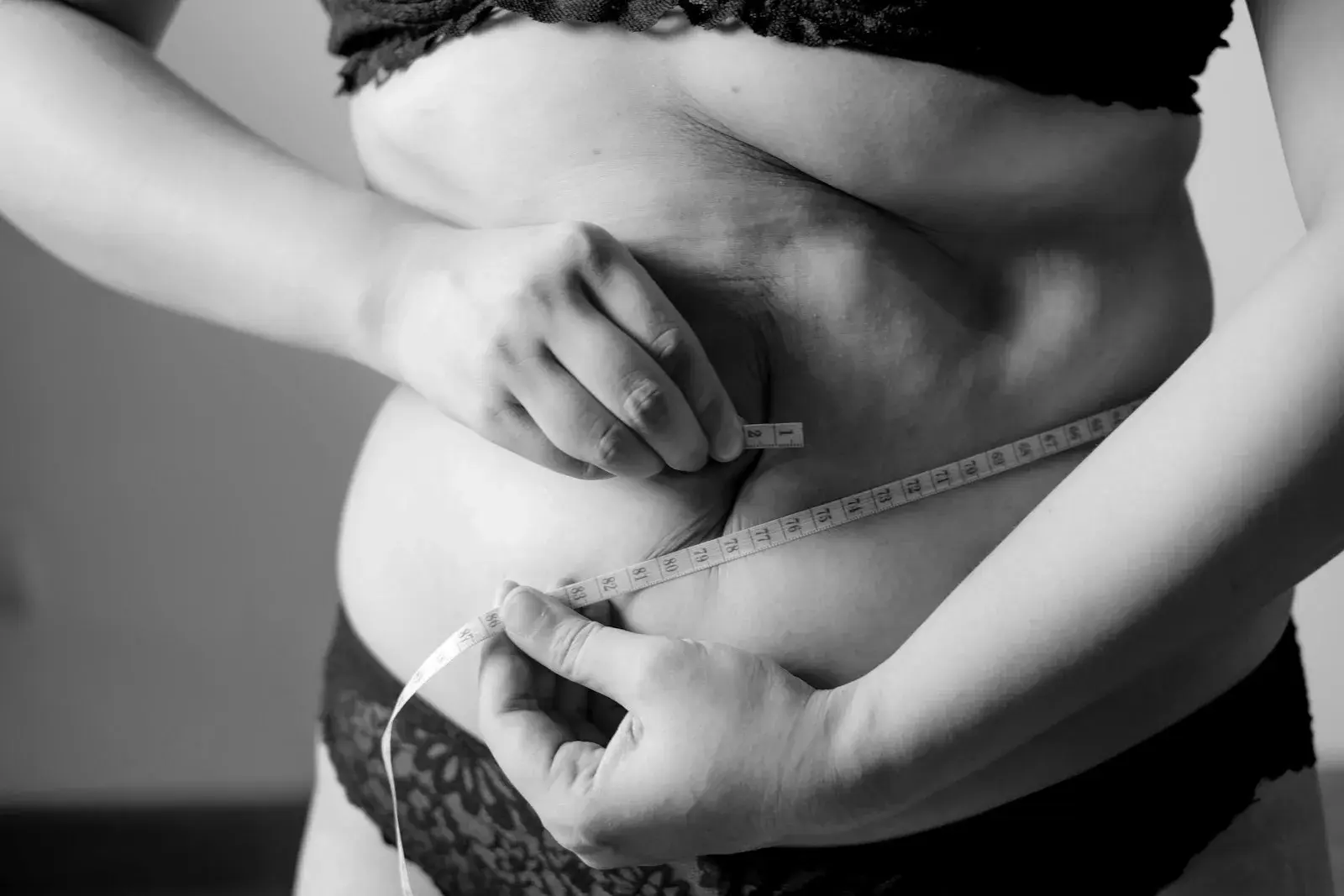 HIFU vs. Cavitation for abdominal fat: which to choose