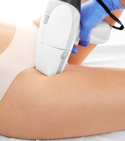 Depilación ELight en playa del carmen