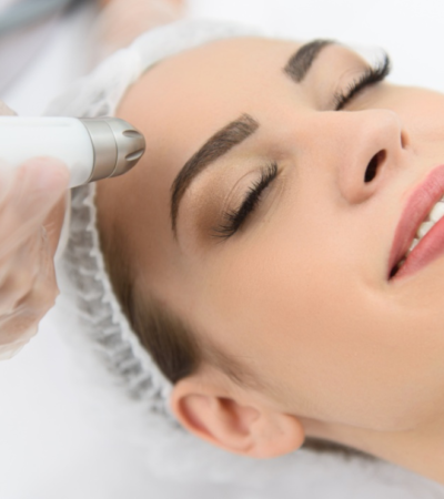 Tratamiento Dermapen